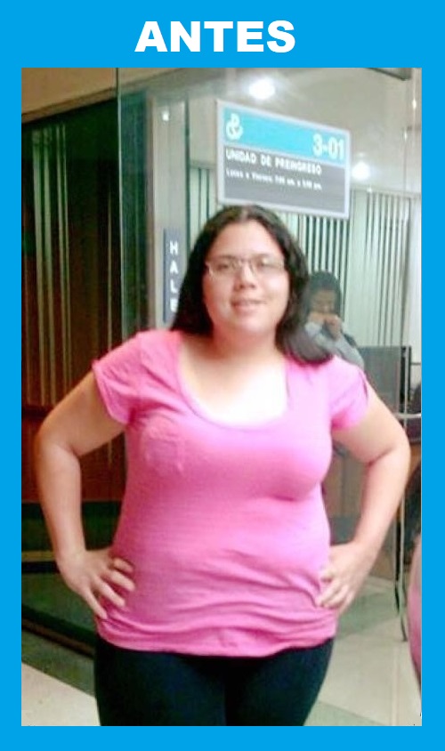 Antes 3