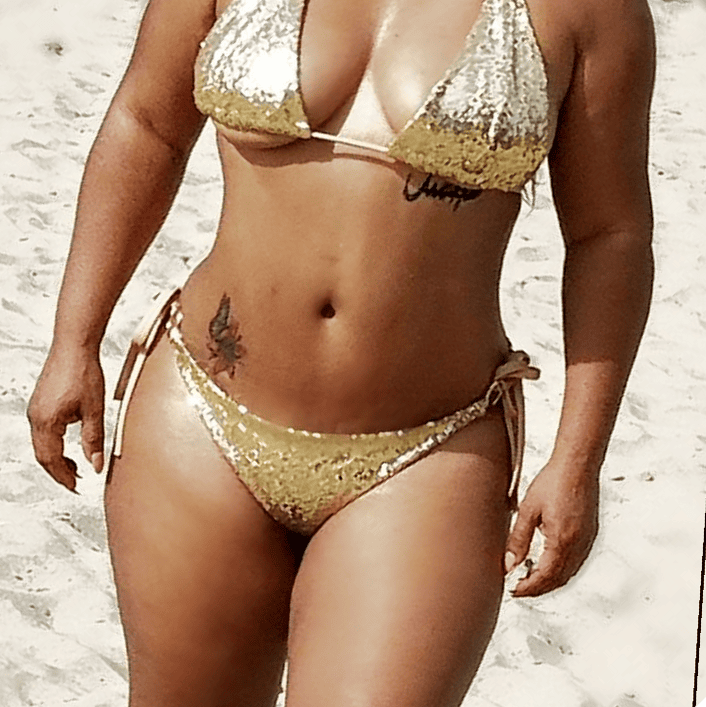 Abdominoplastia Plus